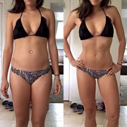 Tüdruk enne ja pärast kehakaalu langetamist süsivesikutevabal dieedil